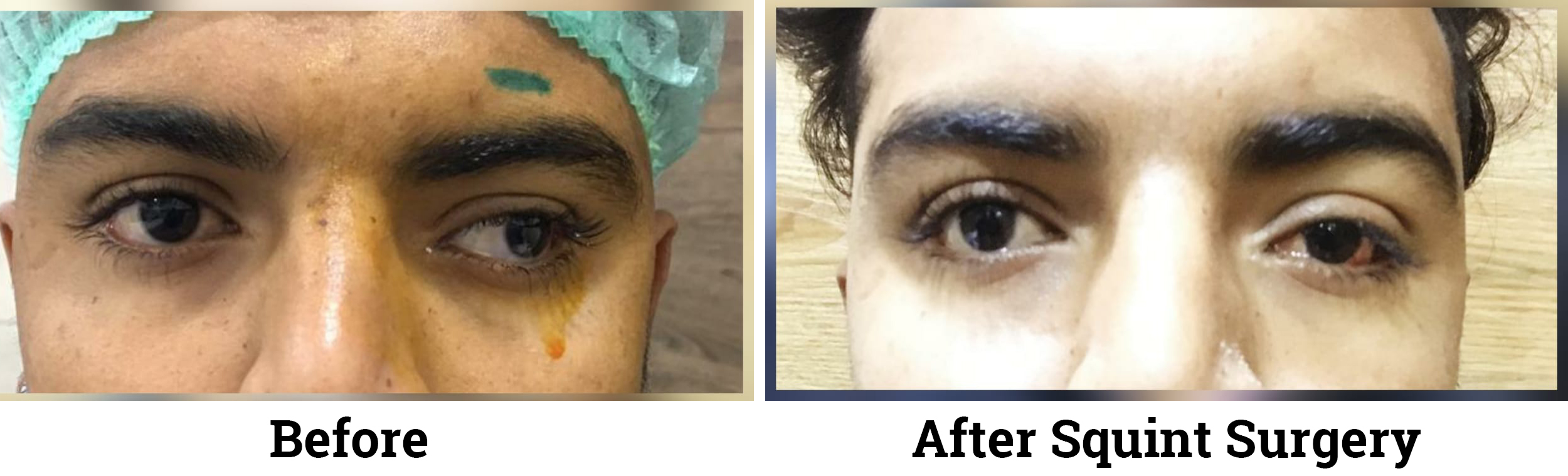 Best Eye Hospital in Bathinda | Vasu Eye Institute & Skin Centre