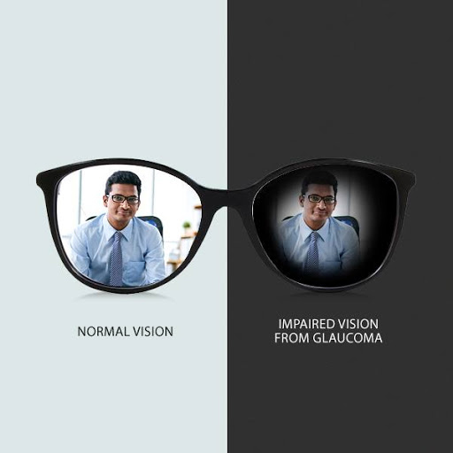 impared-glaucoma at Best Eye Hospital in Bathinda | Vasu Eye Institute & Skin Centre