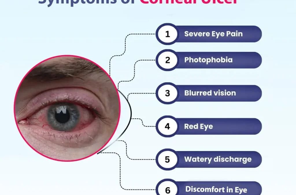 Looking for the Best Hospital in Punjab for Corneal Transplant?