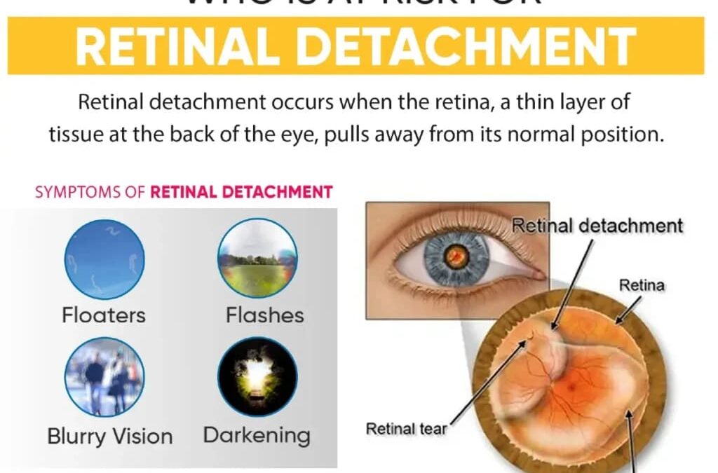 Is Your Vision at Risk? Find Out Why Vasu Eye Institute is the Best for Retina Care!