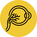 Diabetic Retinopathy