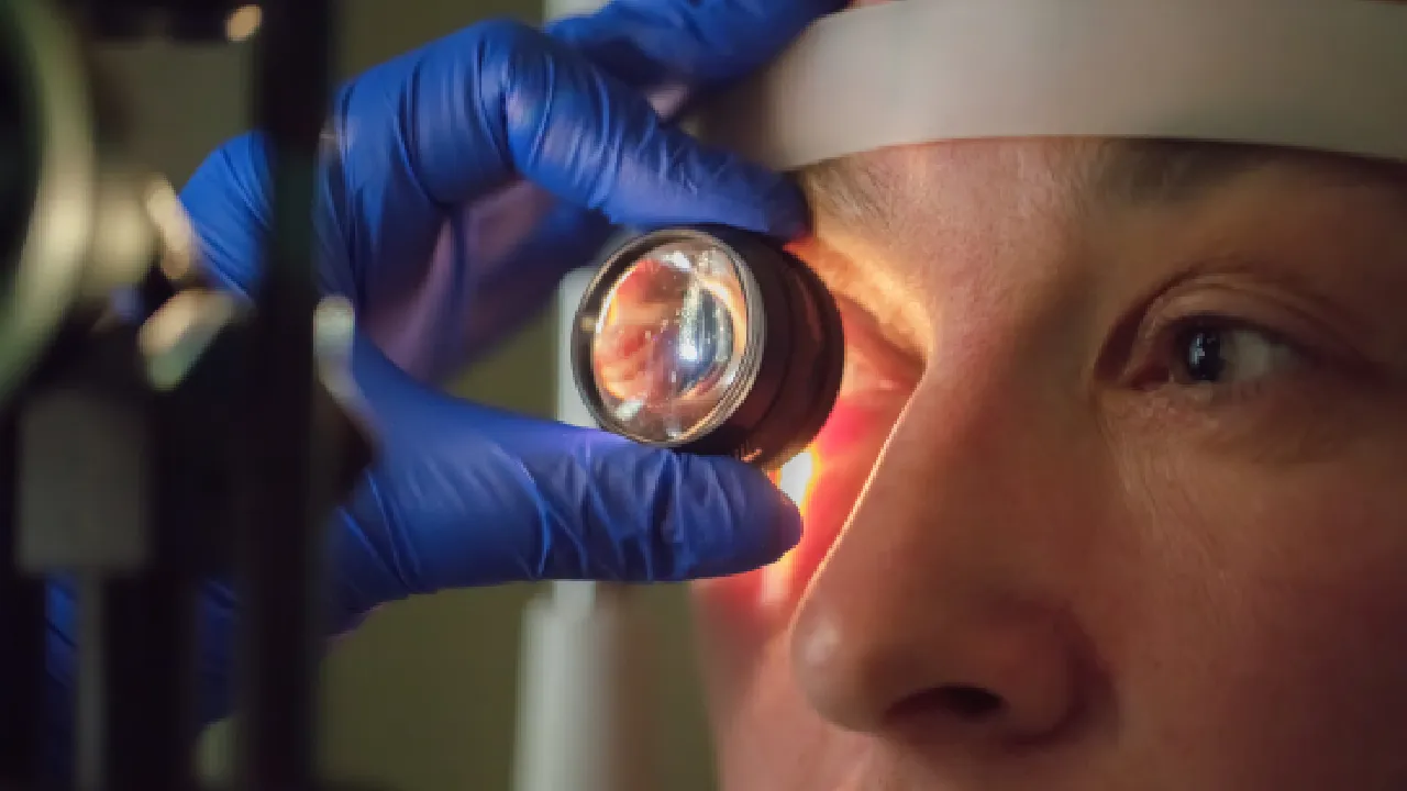 Retina Laser Treatment